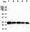 Glutathione S-Transferase Pi 1 antibody, GTX57728, GeneTex, Western Blot image 