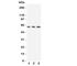 Solute Carrier Family 22 Member 3 antibody, R31294, NSJ Bioreagents, Western Blot image 