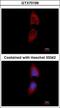 Polyribonucleotide Nucleotidyltransferase 1 antibody, GTX70199, GeneTex, Immunofluorescence image 
