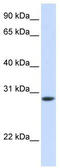 Troponin T3, Fast Skeletal Type antibody, TA339175, Origene, Western Blot image 