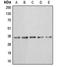Annexin A3 antibody, orb213558, Biorbyt, Western Blot image 