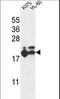 60S ribosomal protein L17 antibody, LS-C162701, Lifespan Biosciences, Western Blot image 