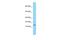 Biogenesis Of Lysosomal Organelles Complex 1 Subunit 2 antibody, A08987, Boster Biological Technology, Western Blot image 