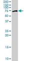 Zinc Finger Protein 133 antibody, H00007692-B02P, Novus Biologicals, Western Blot image 