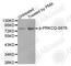 Protein Kinase C Theta antibody, AP0260, ABclonal Technology, Western Blot image 