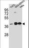 Estrogen Receptor 2 antibody, LS-C157731, Lifespan Biosciences, Western Blot image 