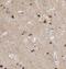 Kinesin light chain 2 antibody, FNab04595, FineTest, Immunohistochemistry paraffin image 