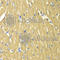 Tropomyosin 3 antibody, A1206, ABclonal Technology, Immunohistochemistry paraffin image 