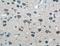 Glutamate Metabotropic Receptor 1 antibody, 19955-1-AP, Proteintech Group, Immunohistochemistry paraffin image 