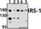 Insulin Receptor Substrate 1 antibody, A00268Y632, Boster Biological Technology, Western Blot image 