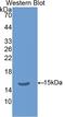 Thyroid Stimulating Hormone Subunit Beta antibody, LS-C301139, Lifespan Biosciences, Western Blot image 