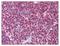 Thymic Stromal Lymphopoietin antibody, AP07802PU-N, Origene, Immunohistochemistry frozen image 