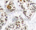 Transcription factor RelB antibody, AP0240, ABclonal Technology, Immunohistochemistry paraffin image 