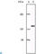 EPH Receptor A2 antibody, LS-C812451, Lifespan Biosciences, Western Blot image 