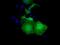 UBX Domain Protein 10 antibody, NBP2-02837, Novus Biologicals, Immunocytochemistry image 