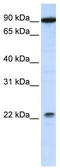 Transmembrane And Tetratricopeptide Repeat Containing 4 antibody, TA335930, Origene, Western Blot image 