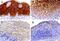 Caspase 14 antibody, PA5-72903, Invitrogen Antibodies, Immunohistochemistry paraffin image 