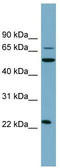 C-Type Lectin Domain Containing 6A antibody, TA336156, Origene, Western Blot image 