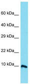 Chromosome 11 Open Reading Frame 94 antibody, TA334119, Origene, Western Blot image 