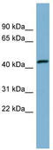 Calcium Release Activated Channel Regulator 2A antibody, TA346647, Origene, Western Blot image 