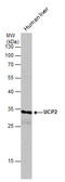 Uncoupling Protein 2 antibody, GTX132072, GeneTex, Western Blot image 