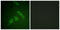 Protein Tyrosine Kinase 2 antibody, LS-C198949, Lifespan Biosciences, Immunofluorescence image 