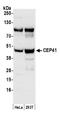 Centrosomal Protein 41 antibody, NB100-93339, Novus Biologicals, Western Blot image 