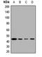 Methionine Adenosyltransferase 2A antibody, LS-C668010, Lifespan Biosciences, Western Blot image 