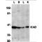 DNA Fragmentation Factor Subunit Alpha antibody, MBS150237, MyBioSource, Western Blot image 