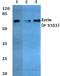 Ezrin antibody, A01750Y353, Boster Biological Technology, Western Blot image 