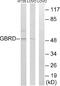 Gamma-Aminobutyric Acid Type A Receptor Delta Subunit antibody, A30688, Boster Biological Technology, Western Blot image 