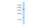 Adenylate Kinase 4 antibody, 29-573, ProSci, Enzyme Linked Immunosorbent Assay image 