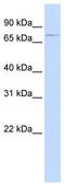 ATP Binding Cassette Subfamily B Member 8 antibody, TA332015, Origene, Western Blot image 