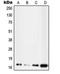 Ubiquitin Conjugating Enzyme E2 D2 antibody, orb214711, Biorbyt, Western Blot image 
