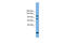 Protein Phosphatase 6 Regulatory Subunit 1 antibody, ARP55109_P050, Aviva Systems Biology, Western Blot image 