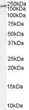 Glutamate Ionotropic Receptor NMDA Type Subunit 2B antibody, GTX89310, GeneTex, Western Blot image 