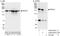 Rho Associated Coiled-Coil Containing Protein Kinase 1 antibody, A300-457A, Bethyl Labs, Immunoprecipitation image 