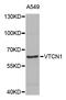 V-Set Domain Containing T Cell Activation Inhibitor 1 antibody, STJ111415, St John