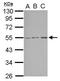 Serine/Threonine Kinase 38 Like antibody, PA5-28252, Invitrogen Antibodies, Western Blot image 