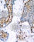 Estrogen Receptor 1 antibody, AP0146, ABclonal Technology, Immunohistochemistry paraffin image 