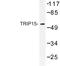 COP9 Signalosome Subunit 2 antibody, LS-C177122, Lifespan Biosciences, Western Blot image 