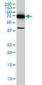 DEAD-Box Helicase 3 Y-Linked antibody, LS-C105070, Lifespan Biosciences, Western Blot image 