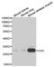 Carbonic Anhydrase 3 antibody, PA5-75998, Invitrogen Antibodies, Western Blot image 