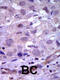 Ret Proto-Oncogene antibody, 63-124, ProSci, Immunohistochemistry paraffin image 