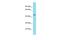 DBF4 Zinc Finger B antibody, PA5-71078, Invitrogen Antibodies, Western Blot image 