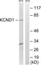 Potassium Voltage-Gated Channel Subfamily D Member 1 antibody, LS-C120235, Lifespan Biosciences, Western Blot image 