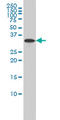 Rab Geranylgeranyltransferase Subunit Beta antibody, LS-C198049, Lifespan Biosciences, Western Blot image 