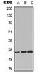 Chloride intracellular channel protein 3 antibody, LS-C358942, Lifespan Biosciences, Western Blot image 