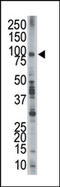 Epidermal Growth Factor Receptor Pathway Substrate 8 antibody, AP15142PU-N, Origene, Western Blot image 