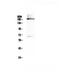 DNA Methyltransferase 1 antibody, A00172-1, Boster Biological Technology, Western Blot image 